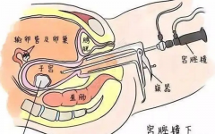 妇科宫腹腔镜 丨 一种让女性不再害怕手术的微创技术