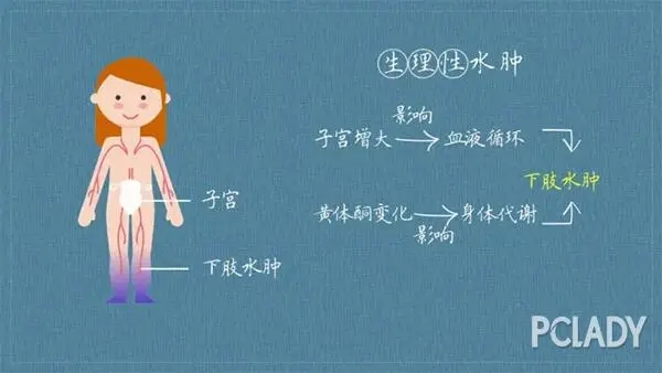 好孕36计 | 孕期毁容式水肿，这种情况你要注意