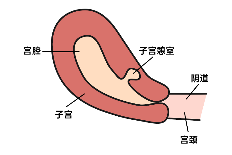 剖宫产后总是“月经淋漓不尽”？当心子宫内部的“壁龛”作祟！